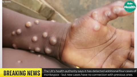 MonkeyPox Video