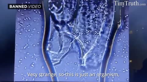 BREAKING : DISTURBING! Pfizer Vaccine Zoomed w Microscope! Are Living Cells Organisms Mixed In!