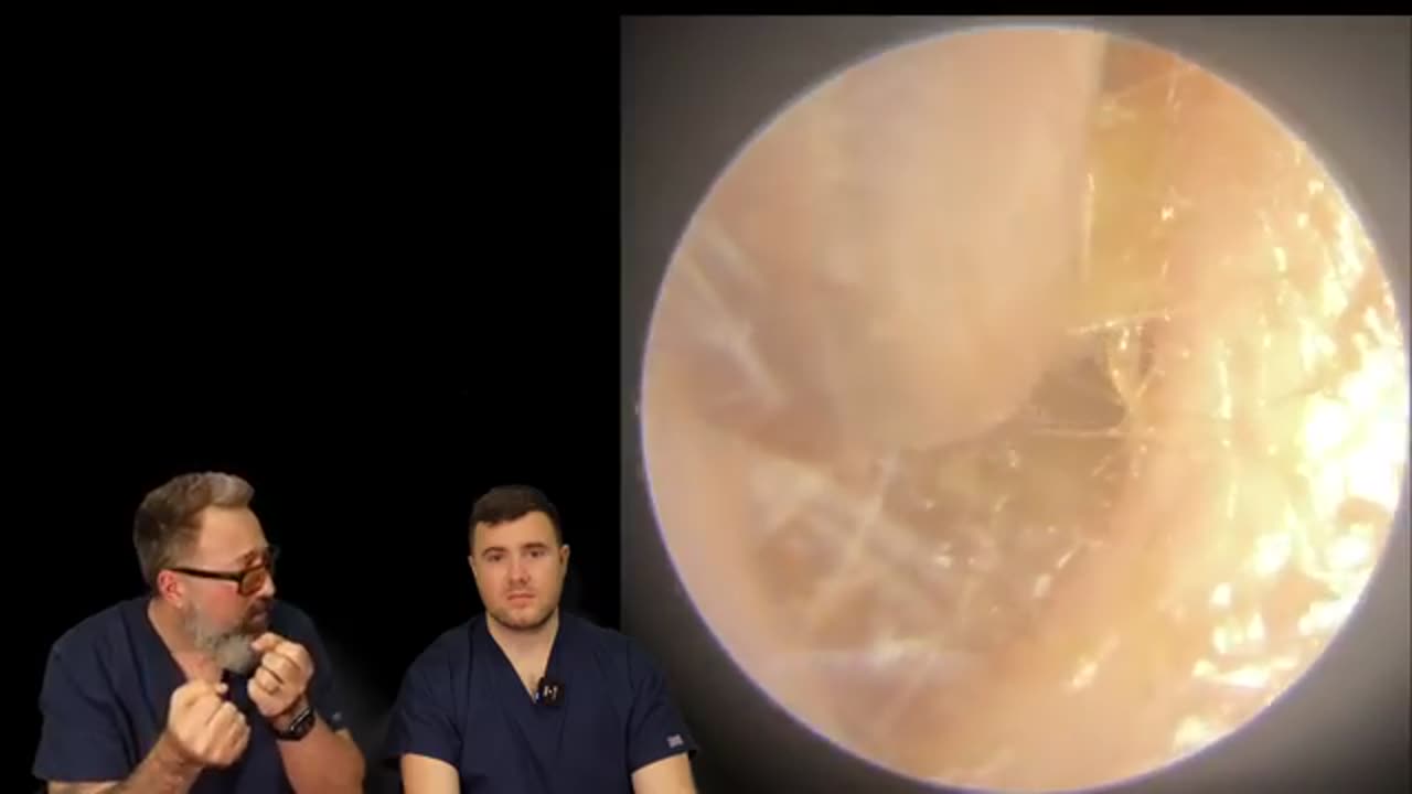 THATS NOT AN EARWAX PLUG! & MORE EAR WAX REMOVALS - EP5