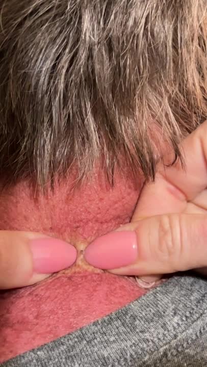 Lil blackhead turns out to be tall