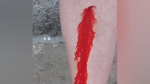 Beautiful bleeding