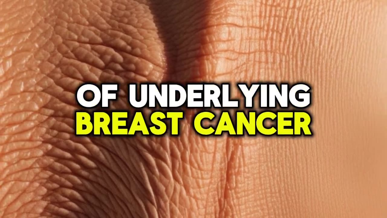 5 Warning Signs of Breast Cancers #health #breastcancer #wellness #healthtips #shorts #nutrition