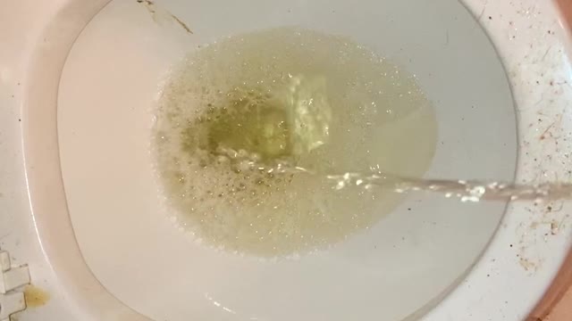 waste of urination