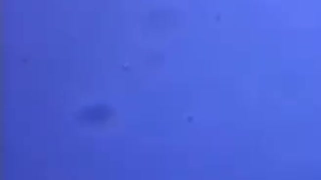 Altre immagini al microscopio del vaccino: Larve, Vita artificiale simile a meduse, Batteri