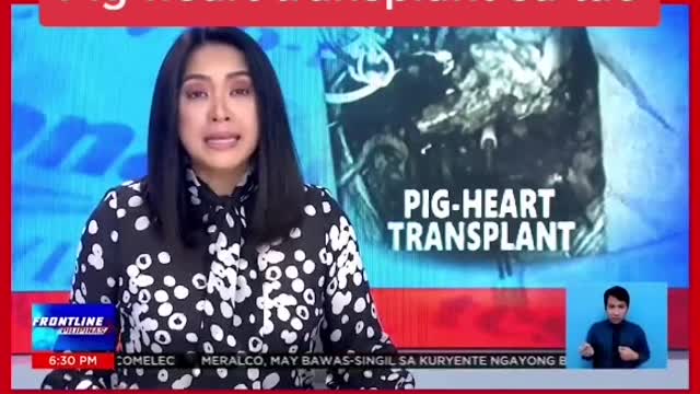 FRONTLINEPILIPINASPia-heart transnlant sa tao