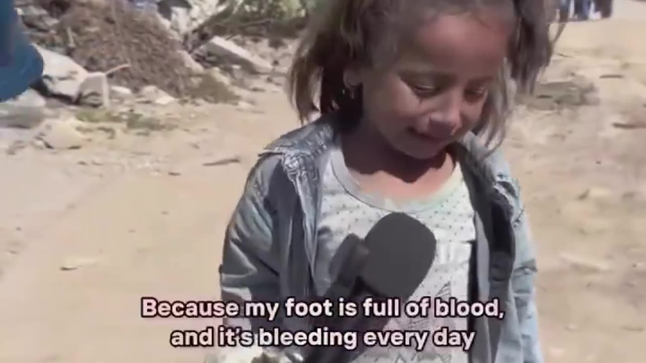 “My foot hurts and I can’t walk. It’s bleeding every day.”