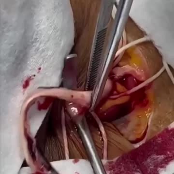 What to expect If you got a Pfizer or Moderna mRNA jab