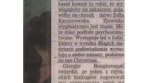 STYGMATYZM JAKO ZJAWISKO - BADANIA STYGMATYKA GIORGIO BONGIOVANNI PRZEZ LEKARZA.