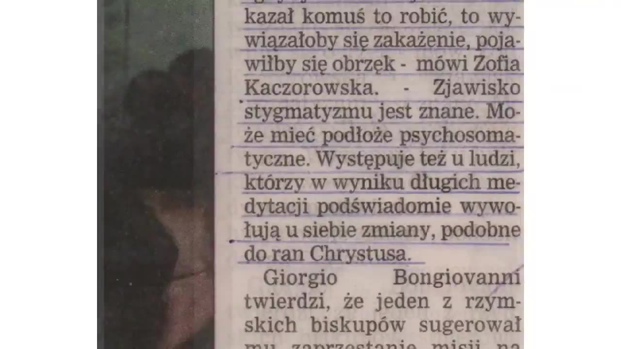 STYGMATYZM JAKO ZJAWISKO - BADANIA STYGMATYKA GIORGIO BONGIOVANNI PRZEZ LEKARZA.