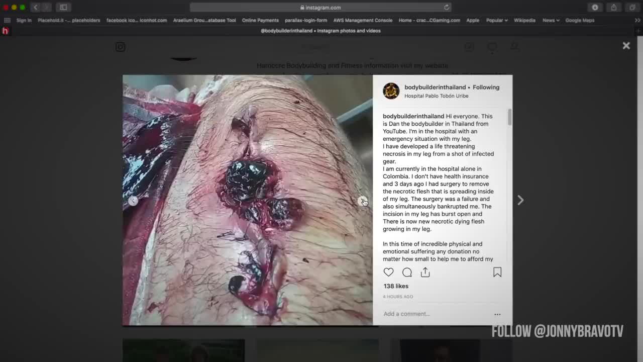 Bodybuilder May Lose Leg from Dirty Steroids - Dan the Bodybuilder in Thailand