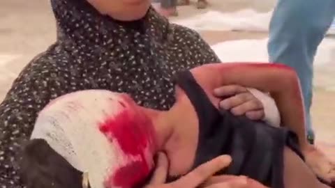 Civilian and children casualties from Israeli bombing of Gaza
