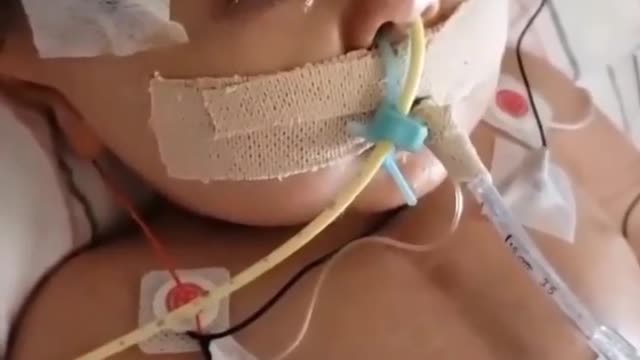 Little Baby Suffering from breathing problem