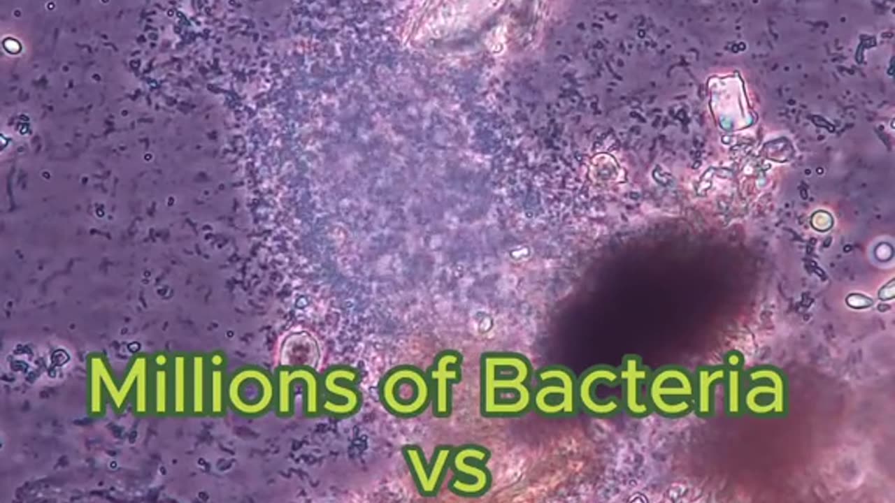 #STEM #biology #bacteria #microscope #microbiology #alcoholvsbacteria #subscribe #mustsee