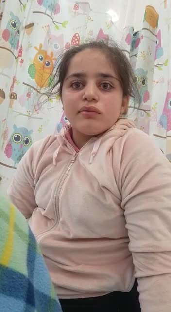 ילדה עם שיתוק בפנים בעקבות חיסון הקורונה