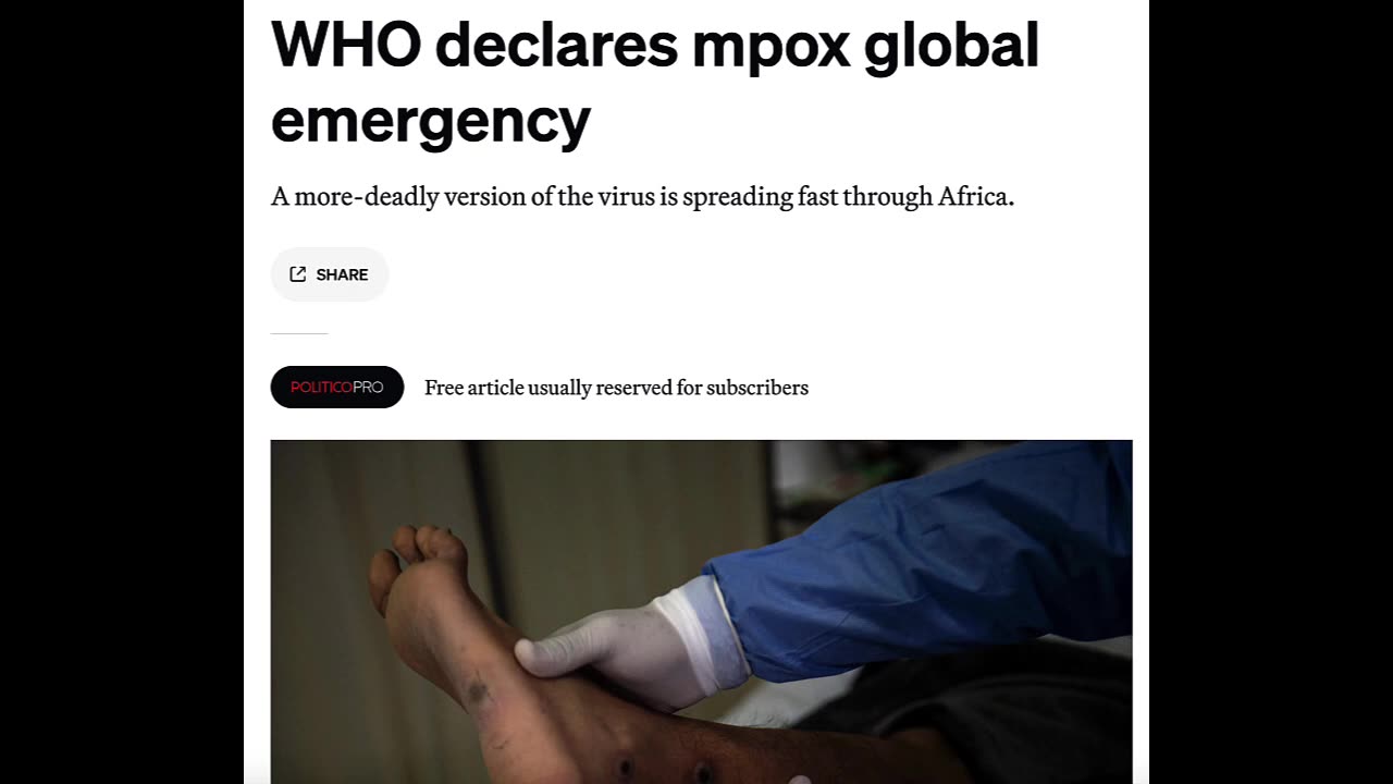 WHO Declares Global Health Monkey Pox Emergency – August 14th, 2024
