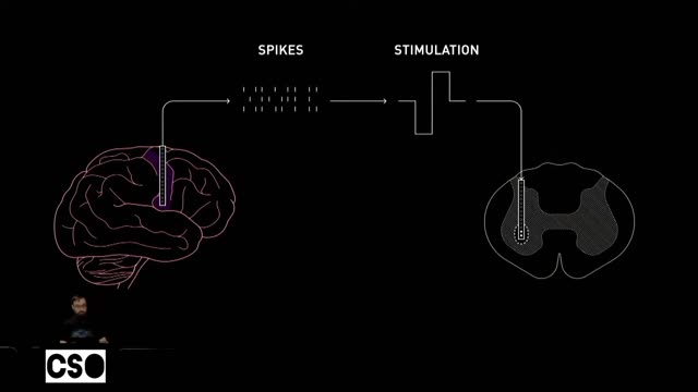 Elon Musk wants to implant radial chips in humans: would you accept it?