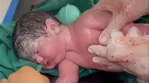 A newborn baby struggles for life.