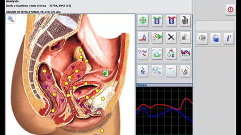 NLS health prevention system