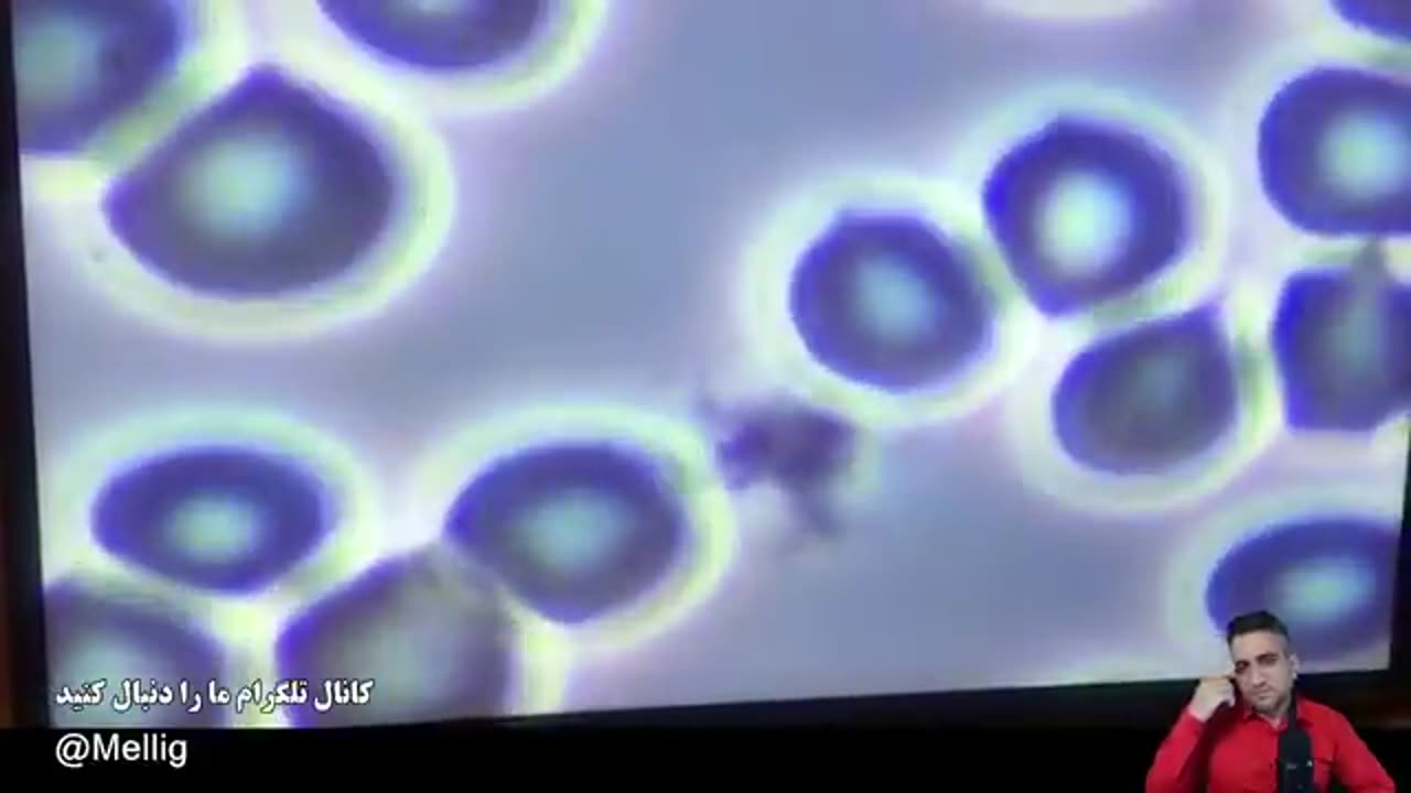 برنامه ۲ خرداد ۲۵۸۰ ملی گرایان مردم گرا که توسط یوتیوب به علت هشدار خطرات واکسن حذف شد