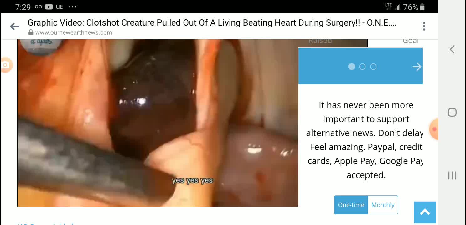 Graphic Video - pulling a clot shot creature out of a human heart