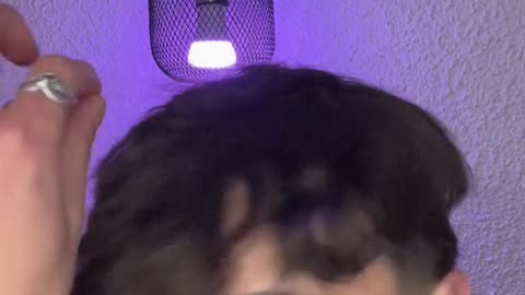 #pov : Si il y'a une marque sur ton visage elle reste pour tjr