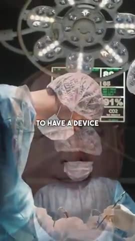 BRAIN CHIPS BEING INSTALLED INTO BRAINS BY BLACKROCK