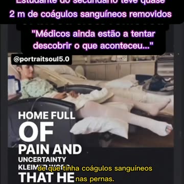💉⚠️Estudante do Secundário teve 2 m de coágulos sanguíneos REMOVIDOS⚠️💉