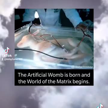 Artificial Wombs