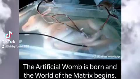 Artificial Wombs