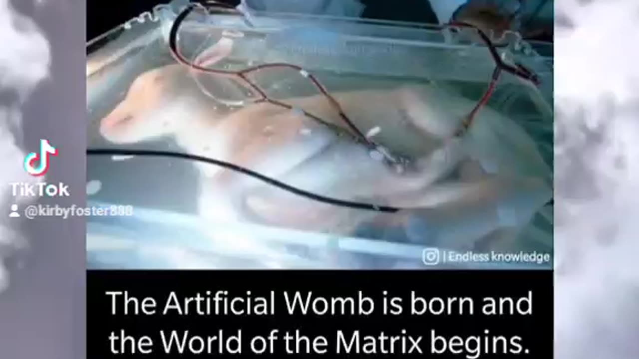 Artificial Wombs