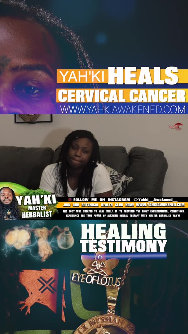 YAHKI HERBAL THERAPY HEALS CERVICAL CANCER!!!!!!!!