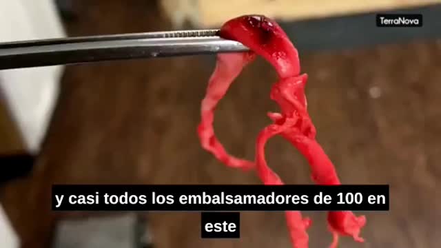 Murió Repentinamente - Died Suddenly Documental