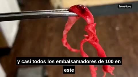 Murió Repentinamente - Died Suddenly Documental