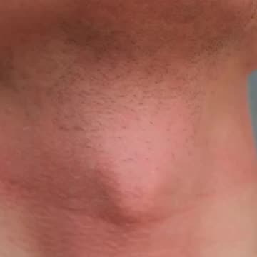 Minty Scalp Care Nourish and Revitalize Your Hair and Scalp!