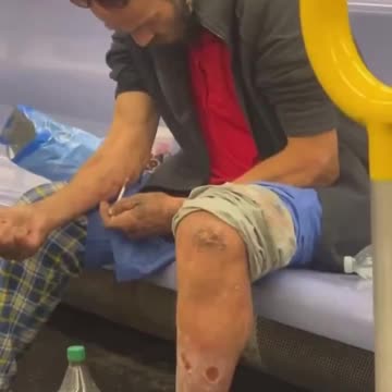 Francisco AIDS Foundation Fueling the Crisis.