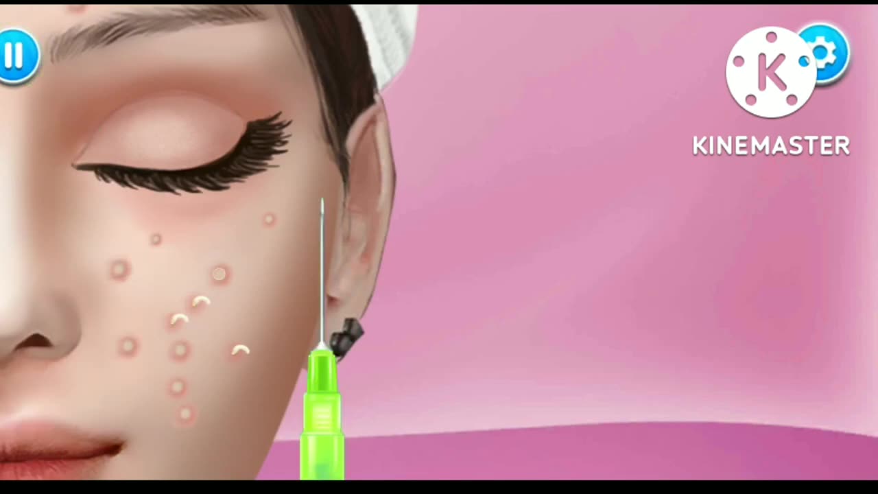 Skin Treatment Video