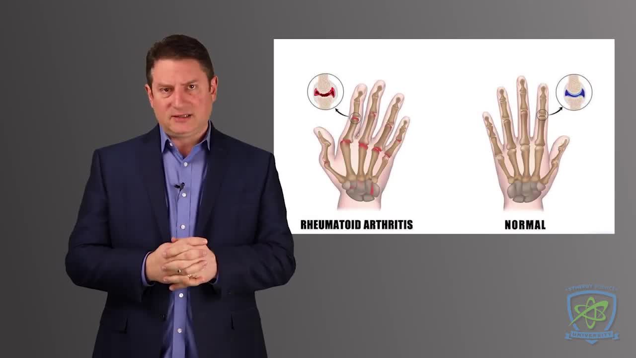 Rheumatoid Arthritis and Hydrogen-rich Water