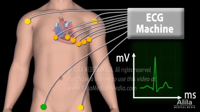 Correlation between Cardiac Action Potential and ECG, Animation