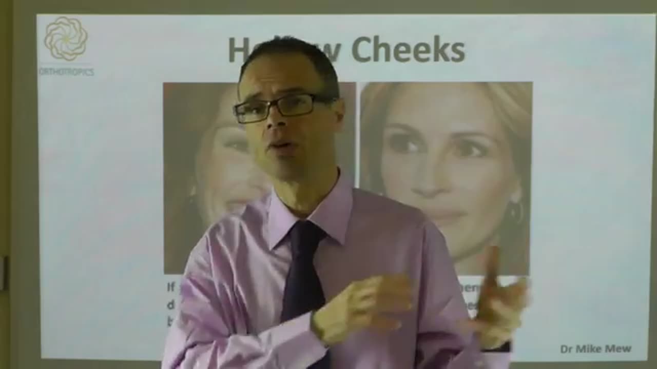 What is Julia Roberts Secret of Beauty, Hollow Cheeks, Wide Smile, Proportionate Face by Dr Mike Mew