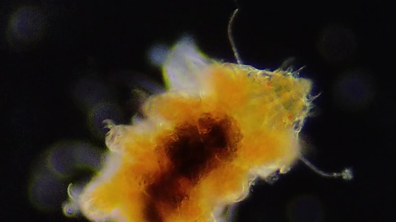 Echiniscus (water bears). And a Rotifer on his back 🙂