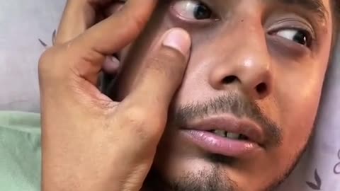 Funny video drop 💧 in eye 👀