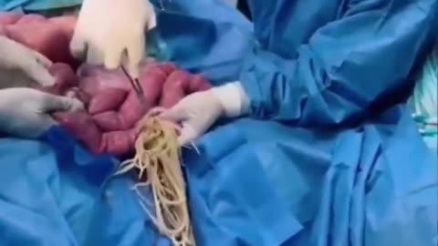 So Many Questions You Wont Believe What Doctors Found