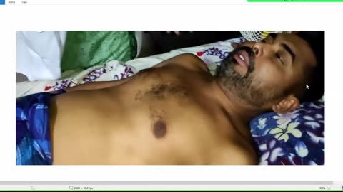 ST5.50 year old man with LOC