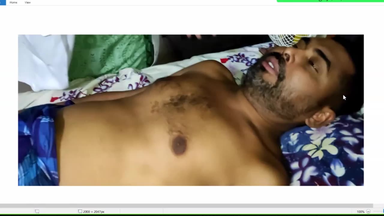 ST5.50 year old man with LOC