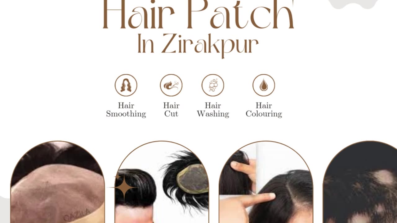 Hair Patch in Zirakpur