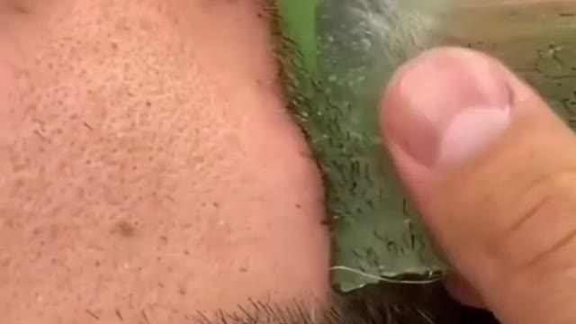 Ağdanın zararlarını biliyor musunuz ?