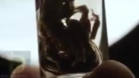 these are not clots they are parasites