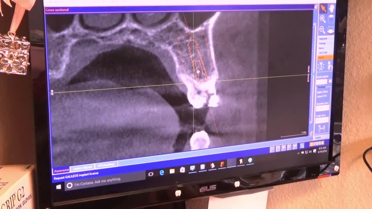 HILLOCK Dental Video Series