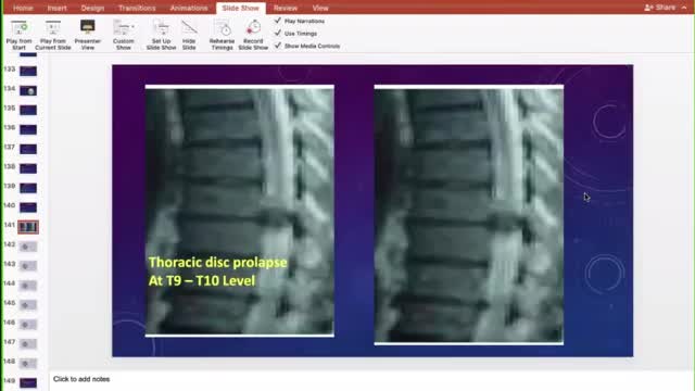 ST5.62 year old man with LL weakness for few days