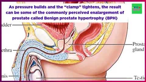 Shrin Your Prostate Gland